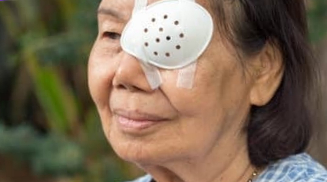 Wajib Tau, Berikut Makanan untuk Mencegah Mata Katarak, Apa saja? 