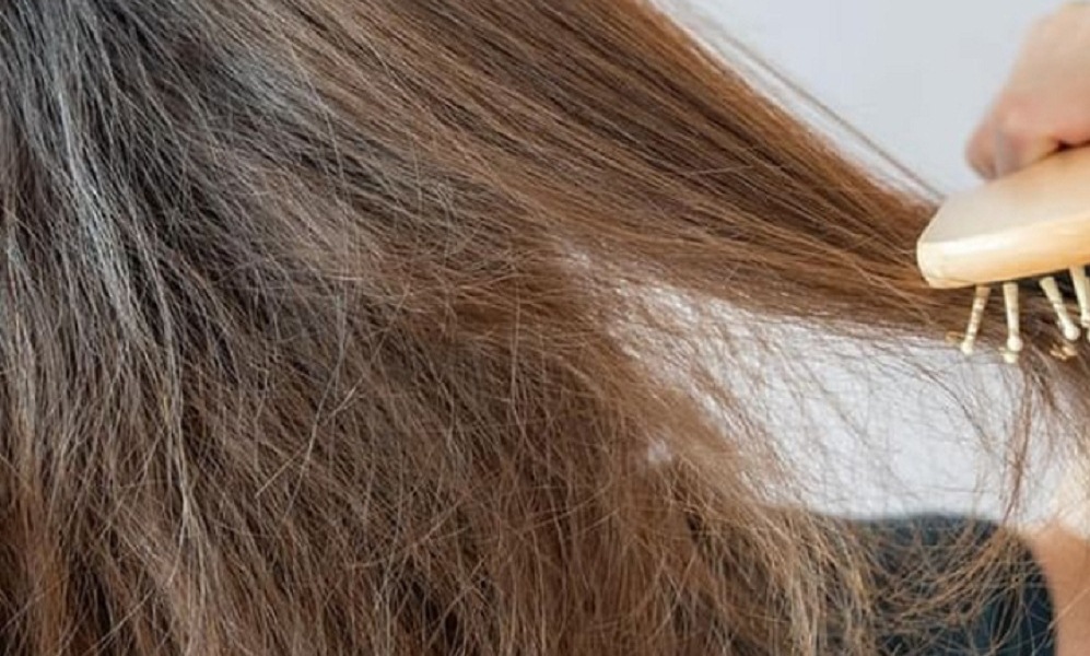 Mencegah Rambut Kering, Faktor Hilangnya Kelembaban Alami Rambut