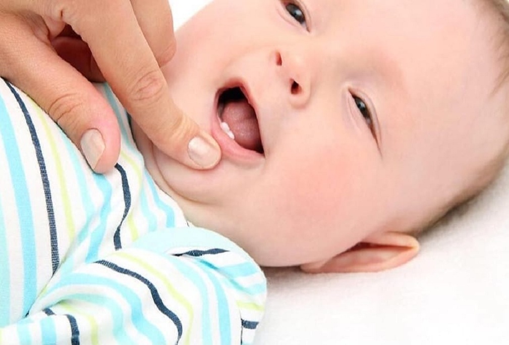 Impian Orang Tua untuk Melihat Timbulnya, Ini Proses Tumbuh Gigi pada Bayi