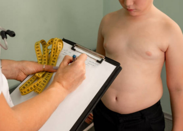 Hati-hati Bun! Obesitas pada Anak Rentan Banyak Penyakit