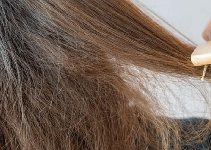Mencegah Rambut Kering, Faktor Hilangnya Kelembaban Alami Rambut